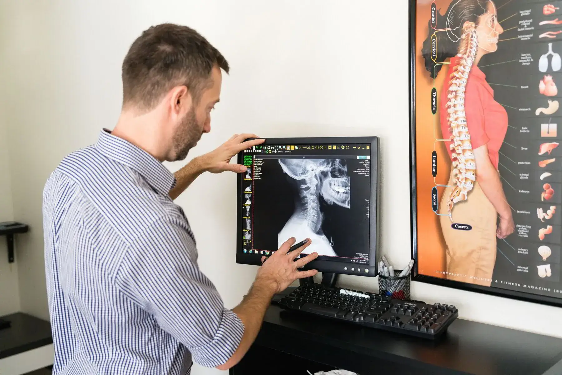 A man in a striped shirt views a cervical spine X-ray on a computer monitor, with an anatomical spine chart on the wall next to it.