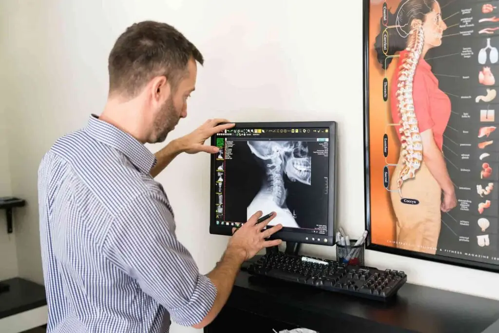 A man in a striped shirt examines a cervical spine X-ray on a computer monitor, with an anatomical chart of the human spine and organs on the wall beside him.